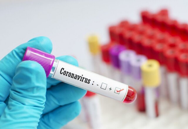 Aktuali informacija gyventojams apie Lazdijų rajone Veisiejų seniūnijoje nustatytus COVID-19 atvejus