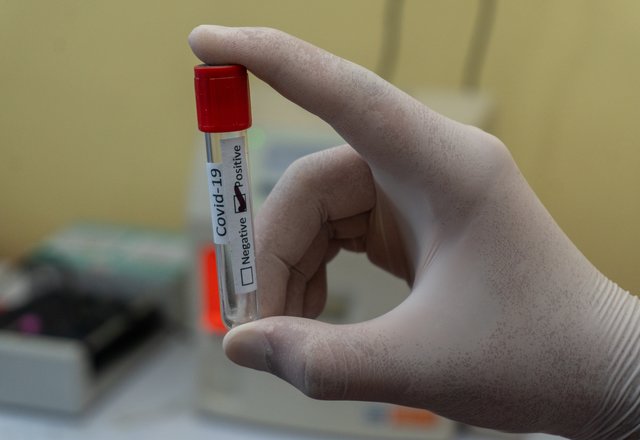 Pirmadienio informacija apie COVID-19 situaciją Lazdijų rajone: serga  61 rajono gyventojas 