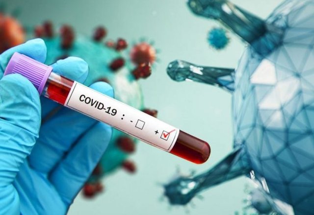 Rajone nustatyti šeši COVID-19 atvejai